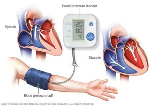 High Blood Pressure Monitoring