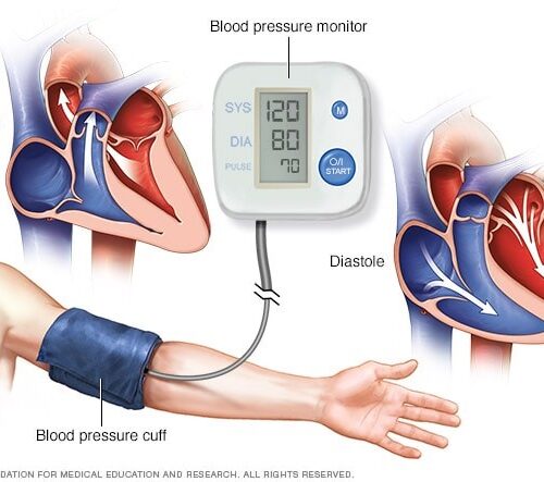 High Blood Pressure Monitoring