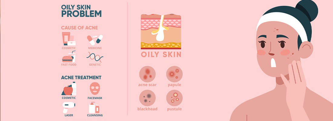 Skin type: Combination acne-prone skin