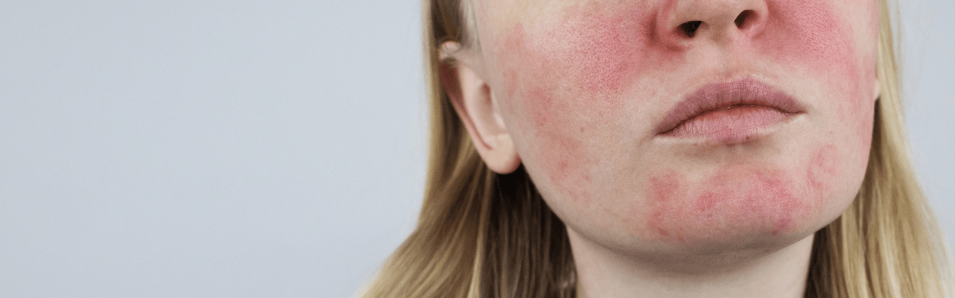 The reasons your face turns red